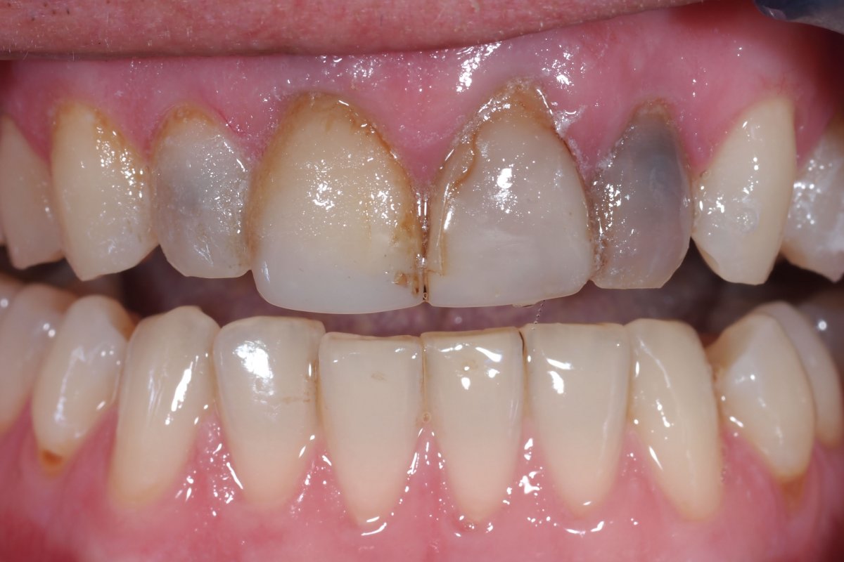 pre-op-photos.jpg